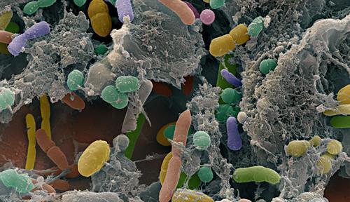 A scanning electron micrograph shows bacteria communities in a human fecal sample. 